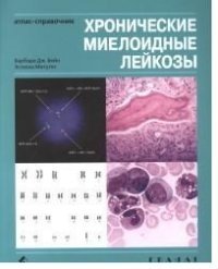 Хронические миелоидные лейкозы. Атлас-справочник фото книги