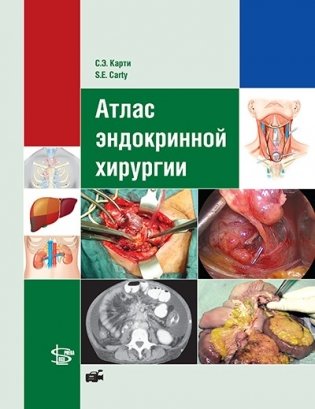 Атлас эндокринной хирургии фото книги