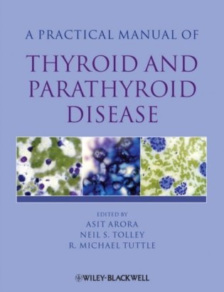 Practical Manual of Thyroid and Parathyroid Disease фото книги