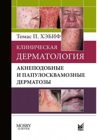 Клиническая дерматология. Акнеподобные и папулосквамозные дерматозы фото книги