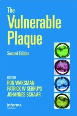 The Vulnerable Plaque, 2E фото книги