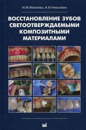 Восстановление зубов светоотверждаемыми композитными материалами. Практическое руководство для врачей стоматологов-терапевтов фото книги