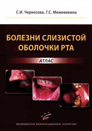 Болезни слизистой оболочки рта: атлас фото книги
