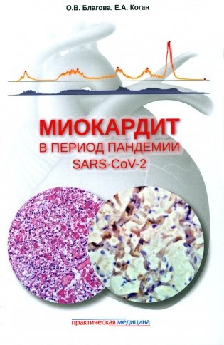 Миокардит в период пандемии SARS-CoV-2 фото книги