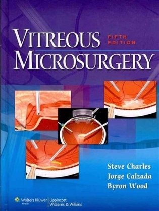 Vitreous Microsurgery фото книги