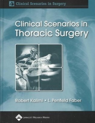 Clinical Scenarios in Thoracic Surgery фото книги