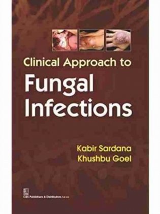 Clinical Approach To Fungal Infections (Pb 2016) фото книги