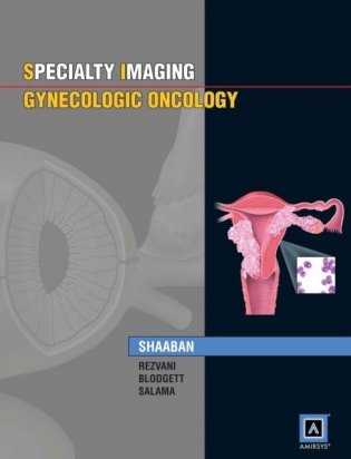 Specialty Imaging™: Gynecologic Oncology: Published by Amirsys® фото книги