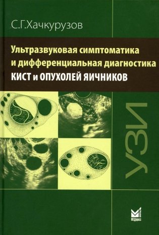 Ультразвуковая симптоматика и дифференциальная диагностика кист и опухолей яичников. 2-е изд фото книги