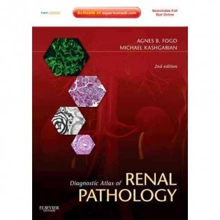 Diagnostic Atlas of Renal Pathology, фото книги