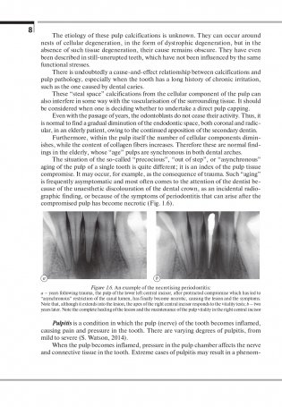 Терапевтическая стоматология. Клиническая эндодонтия (на англ. языке) фото книги 9