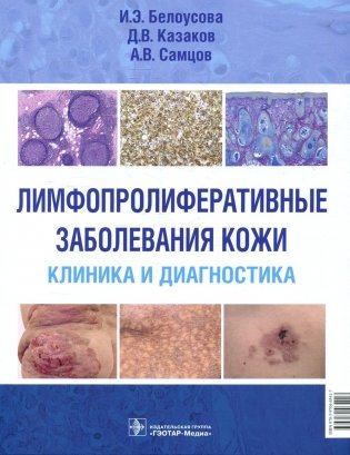 Лимфопролиферативные заболевания кожи. Клиника и диагностика фото книги