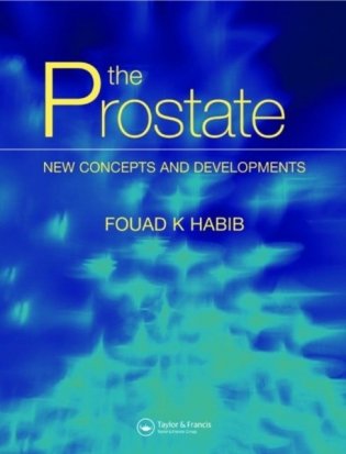 Disorders Of The Prostate фото книги