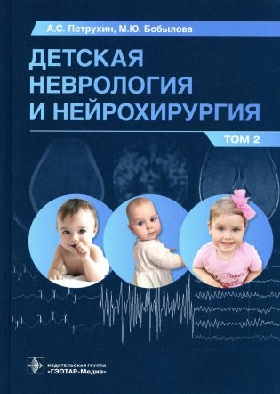 Детская неврология и нейрохирургия: Учебник. В 2 т. Т. 2 фото книги