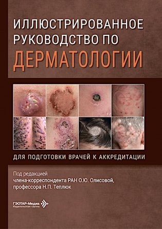 Иллюстрированное руководство по дерматологии. Для подготовки врачей к аккредитации / под ред. О. Ю. Олисовой, Н. П. Теплюк. — Москва : ГЭОТАР-Медиа, 2 фото книги