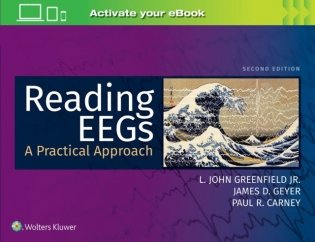 Reading EEGs: A Practical Approach, 2 ed фото книги