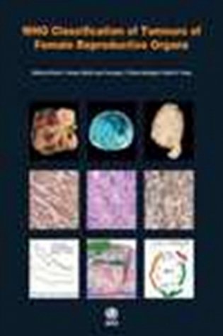 WHO Classification of Tumours of Female Reproductive Organs. Fourth Edition фото книги