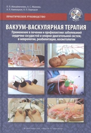 Вакуум-васкулярная терапия (+ DVD) фото книги