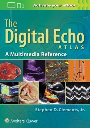 Digital echo atlas фото книги