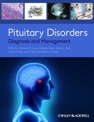 Pituitary Disorders: Diagnosis and Management фото книги