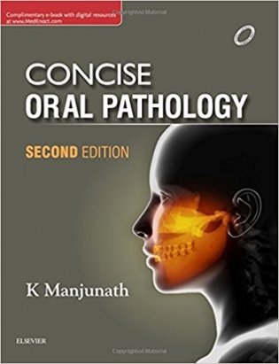 Oral Pathology: Exam Preparatory Manual for Undergraduates фото книги