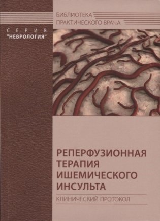Реперфузионная терапия ишемического инсульта. Клинический протокол фото книги