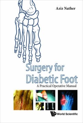 Surgery For Diabetic Foot. A Practical Operative Manual фото книги