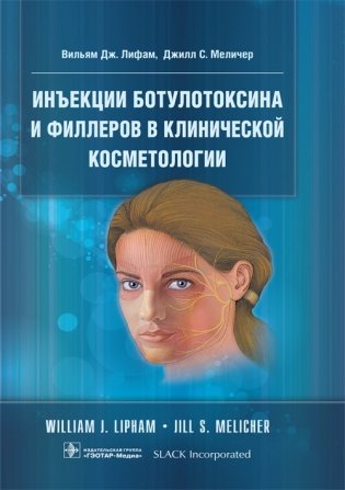 Инъекции ботулотоксина и филлеров в клинической косметологии фото книги
