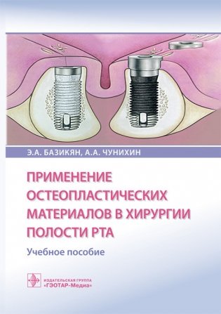 Применение остеопластических материалов в хирургии полости рта фото книги