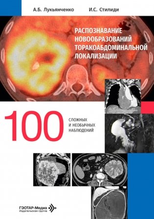 Распознавание новообразований торакоабдоминальной локализации: 100 сложных и необычных наблюдений фото книги