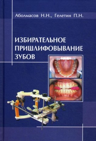 Избирательное пришлифовывание зубов фото книги