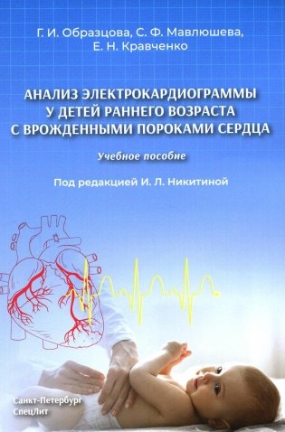 Анализ электрокардиограммы у детей раннего возраста с врожденными пороками сердца. Учебное пособие фото книги