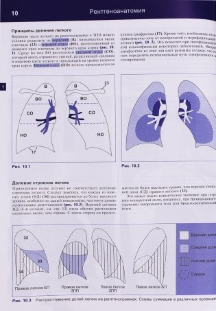 Рентгенологическое исследование грудной клетки фото книги 4