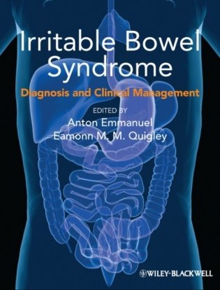 Irritable Bowel Syndrome: Diagnosis and Clinical Management фото книги