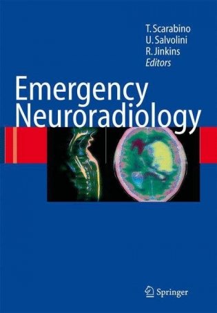Emergency Neuroradiology фото книги