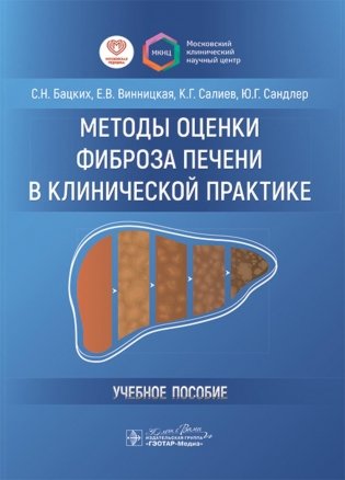 Методы оценки фиброза печени в клинической практике: Учебное пособие фото книги