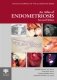Atlas Of Endometriosis фото книги маленькое 2