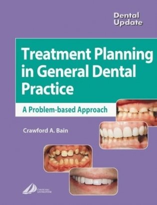 Treatment Planning In General Dental Practice фото книги