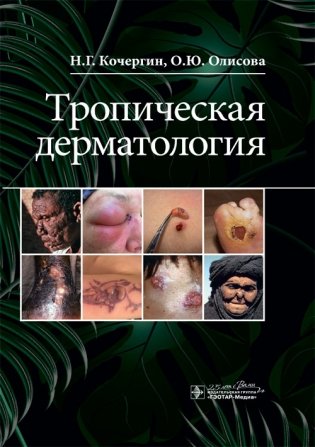 Тропическая дерматология фото книги