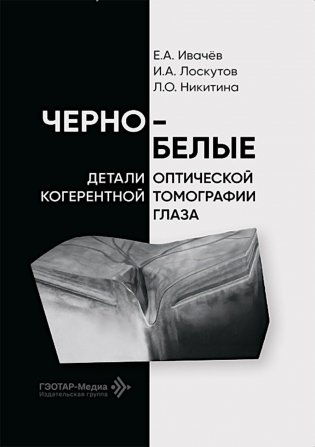 Черно-белые детали оптической когерентной томографии глаза фото книги