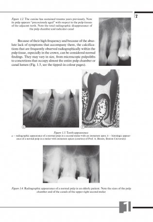 Терапевтическая стоматология. Клиническая эндодонтия (на англ. языке) фото книги 8