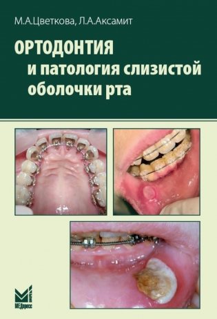 Ортодонтия и патология слизистой оболочки рта фото книги