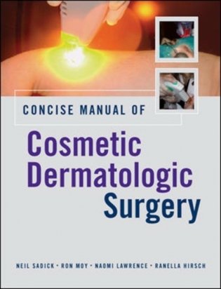 Concise manual of cosmetic dermatologic surgery фото книги