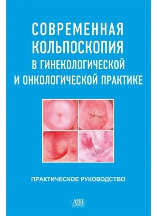 Современная кольпоскопия в гинекологической и онкологической практике фото книги
